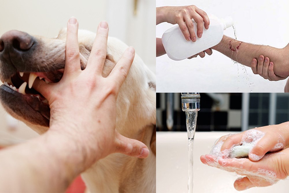 Xử lý vết thương khi bị chó cắn